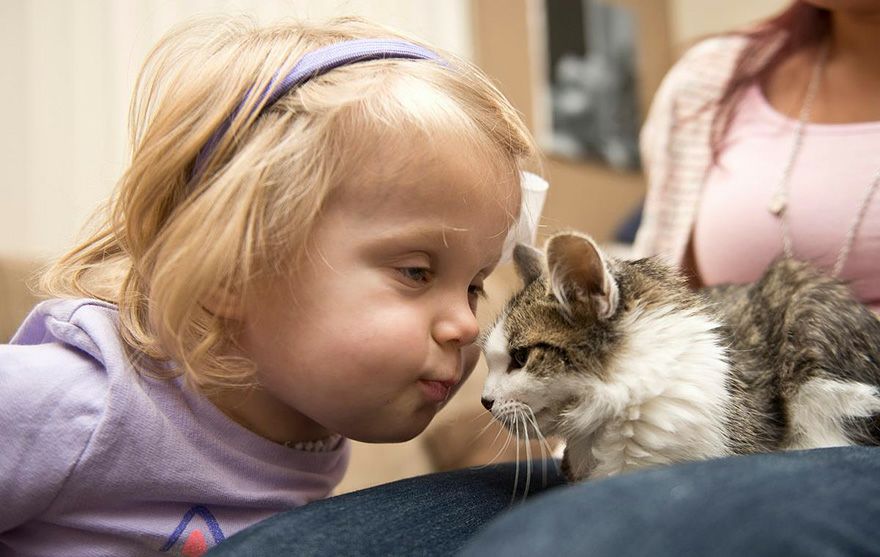 With a missing limb, a three-legged kitten finds solace in the embrace of an amputee girl, their unbreakable bond a testament to resilience and unwavering friendship. - Lillise