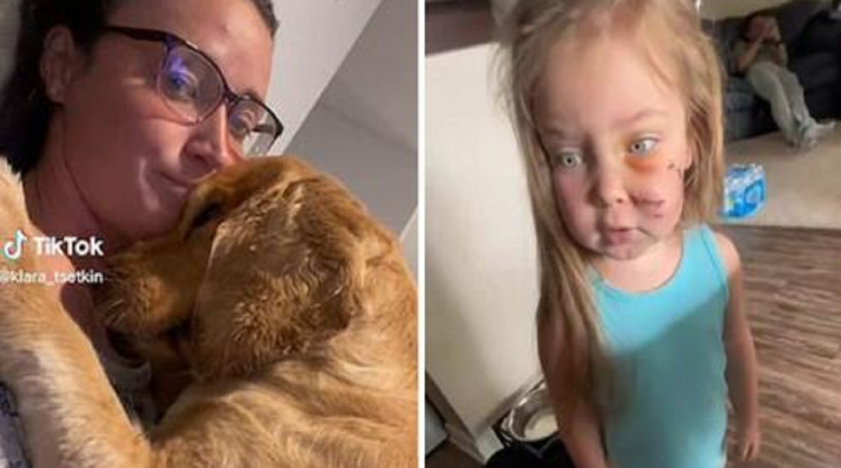 After The Dog Biting Her Daughter In Self-Defense, The Mother Refuses To Kick The Dog Out Of The House