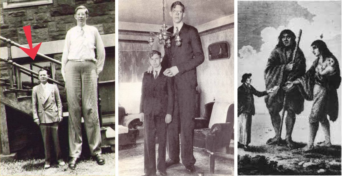 Giant Human 7 to 8 Feet Tall, Larger Than The Average Person, Ever Lived in Ecurdor