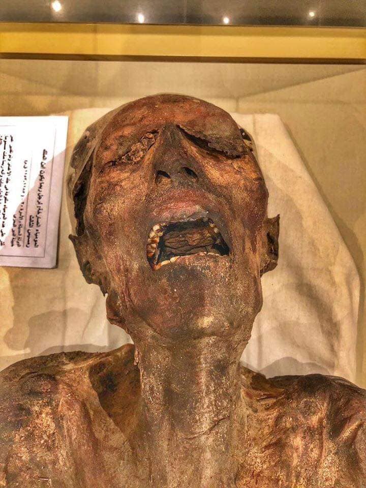 Have experts solved the mystery of the Screaming Mummy? - T-News