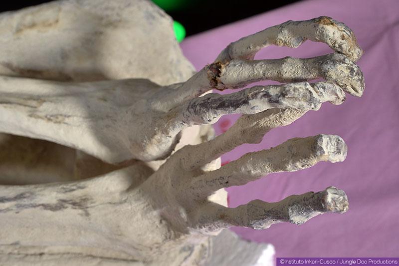 Three-fingered 'mummy' found in Peru may be new species of human, DNA suggests - T-News