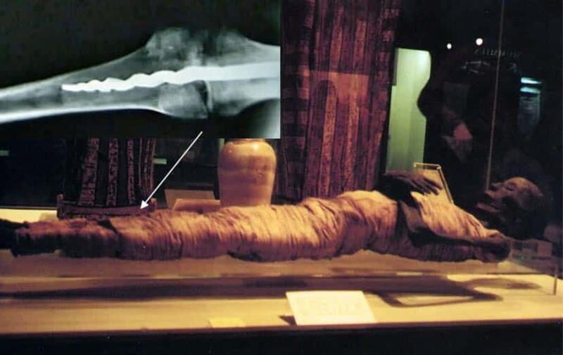 The screw in the 2,600-year-old mummy surprised the scientific world - T-News